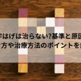 M字はげは治らない基準と原因の見分け方や治療方法のポイントを解説！